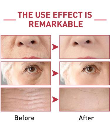  bellv Moisturizing Face Essence Brightening & Plumping Face Essence 1 fl Oz Moisturizing Essence for Skin Care Repair Bellv - Buy Online on GoSupps.com