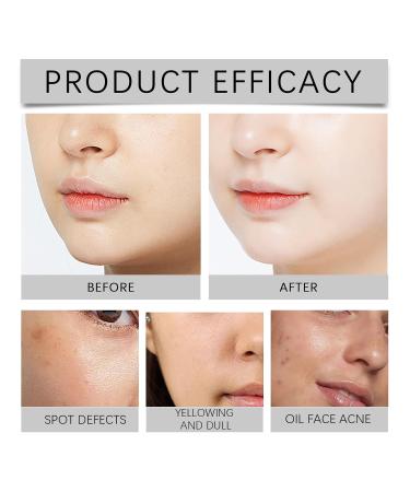 AHA BHA Exfoliating Essence - 30% Glycolic Acid & 2% Salicylic Acid Complex Gently Removes Dead Skin for a Smoother Clearer Complexion - Buy Online on GoSupps.com