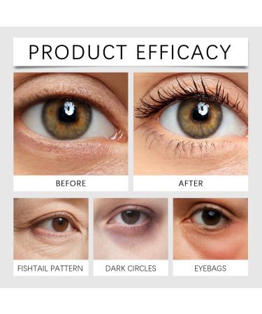 Retinol Lot de 2 cr mes contour des yeux 7 g - R duit les ridules les cernes et les gonflements - Soin des yeux anti- ge - Contre les rides et les cernes - Buy Online on GoSupps.com