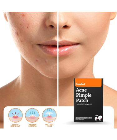Cosyfied Acne Pimple Patch - Invisible Hydrocolloid Spot Cover for Zits & Blemishes | Korean Skincare with Tea Tree & Essential Oils - 108 Dots - Buy Online on GoSupps.com
