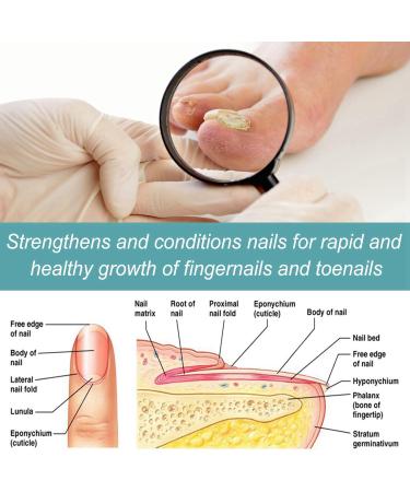 Keratin Nail Growth Oil Keratin 3 Day Growth Nail Treatment & Strengthener Nail Growth Treatment Nail Repair Treatment Nail Strengthener for Damaged Nails Strengthening Nail Polish - Buy Online on GoSupps.com