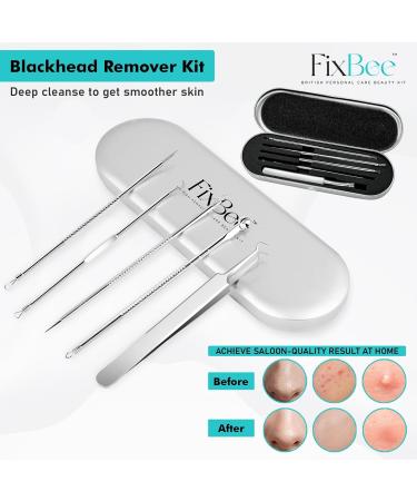 5PC Blackhead & Pimple Removal Kit with Tweezers - Facial Spot Popping Tool Set - Buy Online on GoSupps.com