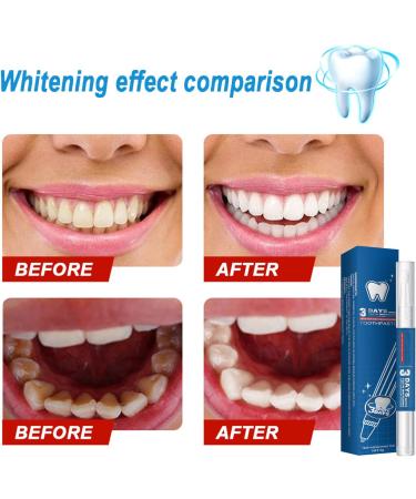Teeth Whitening Pens - 2 Pack Painless Travel-Friendly Stain Remover Gel - Buy Online on GoSupps.com