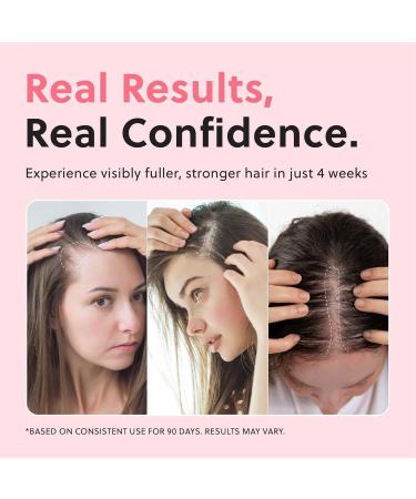  SRBIRD Advanced Natural Hair Growth Oil Spray - Promotes thicker healthier hair repairs and prevents hair loss. 50ml bottle for stronger fuller hair. (2 PCS) - Buy Online on GoSupps.com