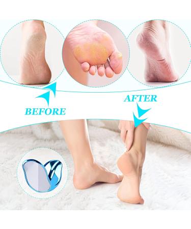 Nano Glass Corneal Remover - 2 in 1 Wet & Dry Cornea Plane for Safe & Effective Foot Care | High Gloss Blue - Buy Online on GoSupps.com