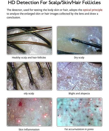 11 Inch Skin Hair Scalp Detector Scalp Hair Follicle Tester Skin Oil Moisture Analyzer Used In Beauty Salons and Hair Care Salons - Buy Online on GoSupps.com