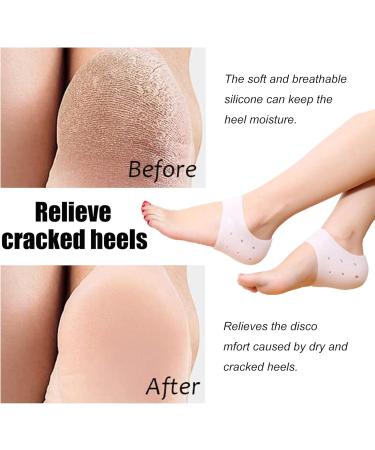 4-Piece Silicone Heel Protection Pads for Pain Relief | Gel Heel Socks for Men & Women - Cracked Heel Solution - Buy Online on GoSupps.com