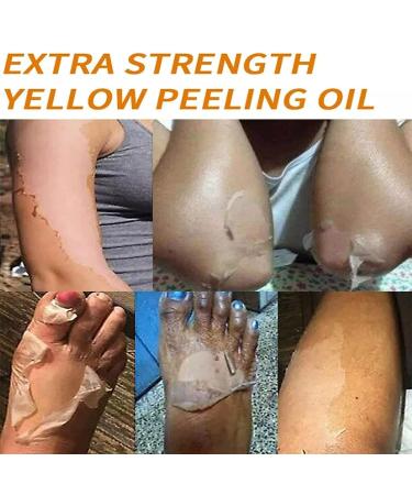 Extra Strong Yellow Peeling Oil | Exfoliating Solution for Body Hands Feet & Face | All Skin Types - 110ML - Buy Online on GoSupps.com