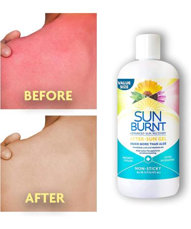 Sunburnt Ultra Hydrating Aloe Vera Gel - Organic Blend for Soothing & Hydrating Dry Skin - 16oz - Buy Online on GoSupps.com