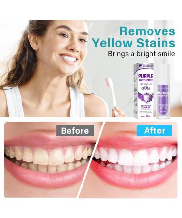 MOLOVA Purple Toothpaste for White Teeth | Effective Non-Irritating Teeth Whitening - Buy Online on GoSupps.com