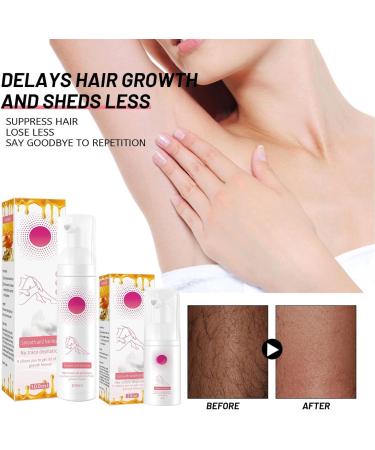 Hair Removal Mousse Gentle Hair Removal Mousse Body Hair Removal Foam Spray for Women and Men Hair Removal Spray Quick Hair Removal Moisturizing and Skin-Friendly (3 Pcs) - Buy Online on GoSupps.com