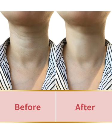 Silicone Anti-Wrinkle Pads for Neck - Overnight Hydrating Comfort for Youthful Skin - Buy Online on GoSupps.com