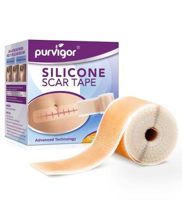 Silicone Scar Tape Roll, 1.6” x 60” Medical Tape for Wound Care Bandages Scars Strips for Surgical Scars Keloid, C-Section, Burns, Injuries Acne, Stretch Marks Removal Sheet Tapes