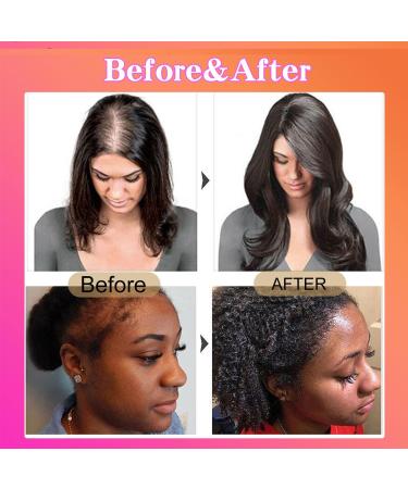 2 Bottles Pack of Raw Batana Oil for Hair Growth - Pure Organic Batana Oil - Revitalizes Hair Strength Prevents Hair Loss Moisturizes Scalp  - Buy Online on GoSupps.com