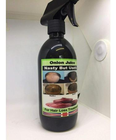 Jus d'oignon pour perte de cheveux gonfl s infections du cuir chevelu secs ou d mangeaisons du cuir chevelu sans odeur 500 ml - Buy Online on GoSupps.com