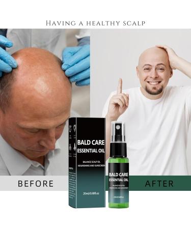 Bald Scalp Care | 20ML Soothing Natural Liquid Scalp Moisturizer | for Follicles Tension and Irritation. Suitable for Men Dads Colleagues and Girlfriends - Buy Online on GoSupps.com