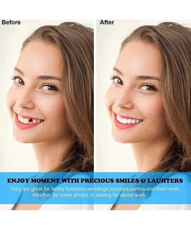 YTXY Instant Cosmetic Teeth - 2 Pairs of Temporary Dental Veneers for Whitening & Denture Cover - Buy Online on GoSupps.com