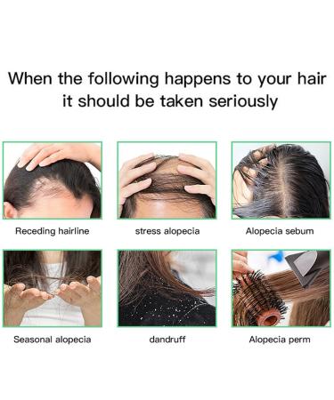 Hair Wax Stick & Rosemary Oil - Organic Hair Growth Products | Flyaways Control & Slick Back Hair Accessories for Women | SET 01 - Buy Online on GoSupps.com