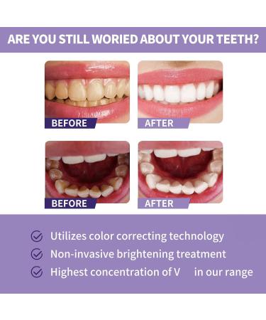 His Smile Teeth Whitening Color Corrector - Purple Toothpaste for Stain Removal (1PC) - Buy Online on GoSupps.com