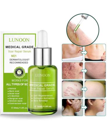 Advanced Scar Repair Serum - Intensive Overnight Cream for Face & Body - Nature Scar Treatment Gel - Pregnancy Safe - Smoothing Skin Care Essence (Green) - Buy Online on GoSupps.com