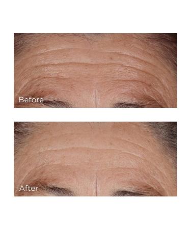 Perricone MD Hyaluronic Intensive Hydrating Serum - 2 fl. oz - Buy Online on GoSupps.com