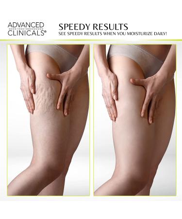 Advanced Clinicals Green Coffee Bean Oil Thermo-Firming Cream 16 oz | Skin Firming & Moisturizing - Buy Online on GoSupps.com