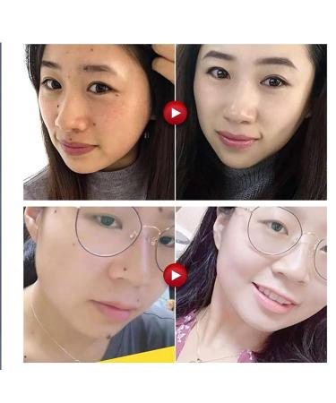 Huangfutang Herbal Formula Skin Cleanup Ointment Cream - 2 Pcs - Buy Online on GoSupps.com