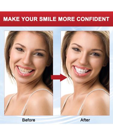 SP 8 Probiotic Toothpaste for Whitening | Ultra Whitening Fresh Breath & Deep Cleaning Care | Includes Toothbrush | International Shipping Available - Buy Online on GoSupps.com