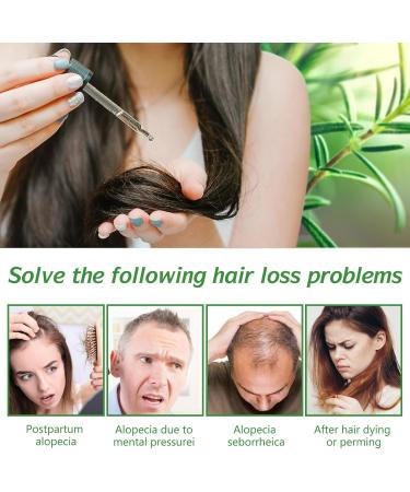 Rosemary Oil for Hair Growth & Skin Care -120ml 100% Pure Rosemary Essential Oil for Eyebrow and Eyelash Nourishes The Scalp Stimulates Hair Growth for Men Women - Buy Online on GoSupps.com