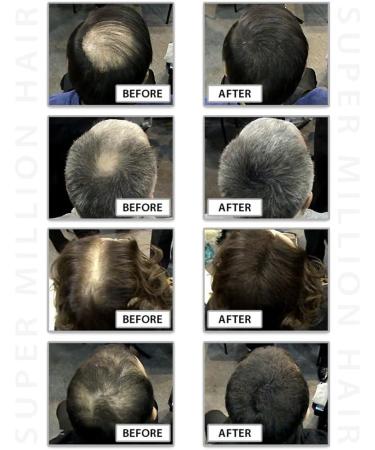 Super Million Hair 1 x 25g Hair Building Fibers No. 6 Light Blonde - Buy Online on GoSupps.com