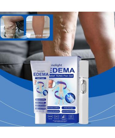 FRTG Varicose veins cream varicose veins with blue light laser treatment pen 1 treatment with blue light laser 1 Varicose Vein Soothing Cream treatment of varicose veins on the legs - Buy Online on GoSupps.com