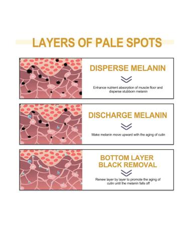 Kasumi Abera Whitening Cream - Japanese Premium Face Cream for Dark Spot Reduction | Suitable for All Skin Types | 1PCS - Buy Online on GoSupps.com