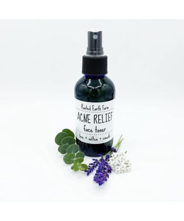 Acne Relief Face Toner - 4 fl oz - for Clear Skin - Natural Astringent - Buy Online on GoSupps.com