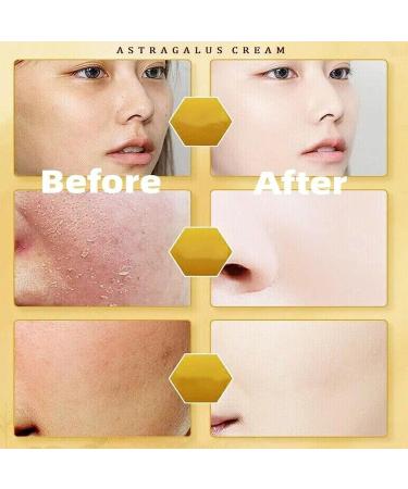  JASUBAI Set of 4 emollient creams for astragalus - 70 g - Moisturizing cream - Anti-aging to reduce and repair the face eyes neck and fine lines - Buy Online on GoSupps.com