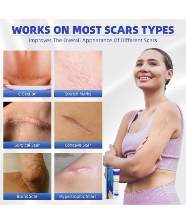 Scar Cream Silicone Gel for Old and New Scars - Advanced Formula for Keloids, Surgery, Acne - 1.5 OZ - Visible Results - All Skin Types - Buy Online on GoSupps.com