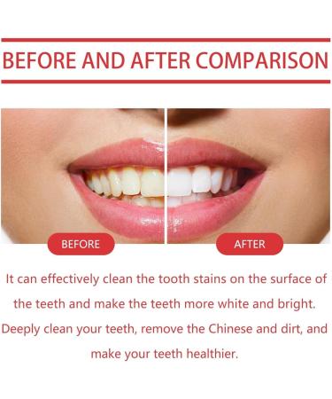 SP 8 Ultra Whitening Toothpaste & Probiotic Toothpaste (2PC) - Effective Teeth Whitening & Dental Care | Ships Internationally - Buy Online on GoSupps.com