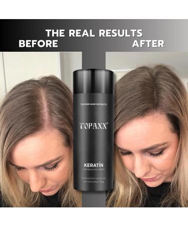 Hair Building Fibers 2-in-1 Kit - Thickening Fibers & Spray Applicator for Men & Women | Conceal Thinning Hair (Dark Brown - Buy Online on GoSupps.com