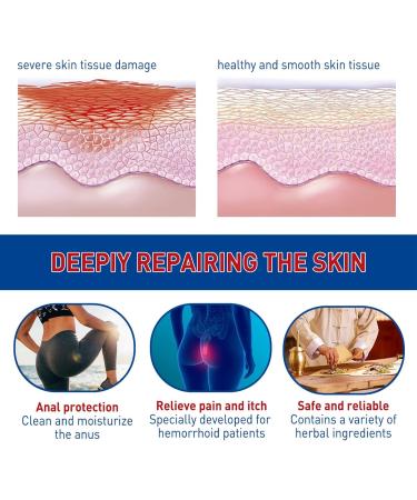 2 Pcs Hemorrhoid Cream Hemorrhoid Cream Body Creams Soothing Itching Burning Symptom Treatment Ointment Herbal Soothing Itching Ointment - Buy Online on GoSupps.com