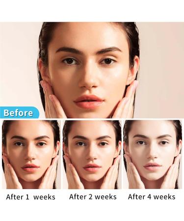 Niacinamide Face Toner Moisturize Refreshing Toner Refreshing and Non-Greasy Facial Toner Suitable for All Skin Types - Buy Online on GoSupps.com