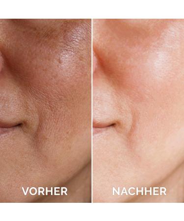 VITAYES Vitamin C Face Serum - Anti-Aging Hydrating Serum with Hyaluronic Acid for Dark Spots Fine Lines & Wrinkles - 1 Oz - Buy Online on GoSupps.com