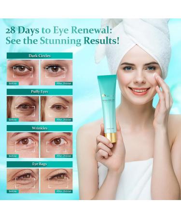 HOLYOM Eye Cream for Dark Circles & Puffiness Reduces Eye Bags Wrinkles & Fine Lines | Hydrating Under Eye Care for Women - Buy Online on GoSupps.com