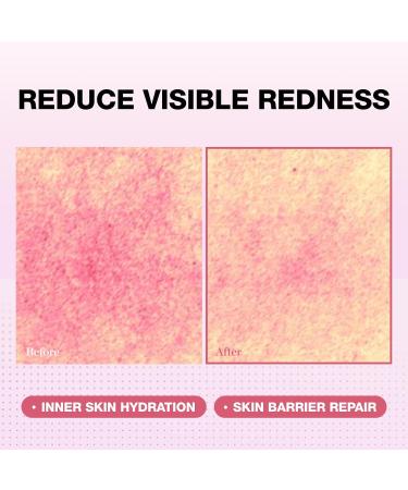 Physiogel Red Soothing Essence Reduces Redness Hydration for Dry & Sensitive Skin Fragrance-Free Non-Comedogenic Dermatologist-Tested Lightweight - Buy Online on GoSupps.com