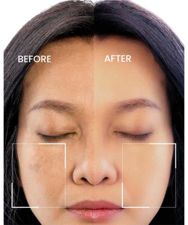 Elir Radiance & Renewal Serum with Hyaluronic Acid Vitamin C & Kojic Acid Hydrating Anti-Aging Formula for Smooth Even-Looking Skin Tone & Texture 30ml - Buy Online on GoSupps.com