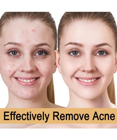 Glycolic Acid 7% Toning Resurfacing Solution - Glycolic Sour 7% Toner - Hydrating Toning Solution - Skincare Hyaluronic Acid Serum - for Blemishes and Acne Prevents Skin Aging Strengthen Your Skin - Buy Online on GoSupps.com