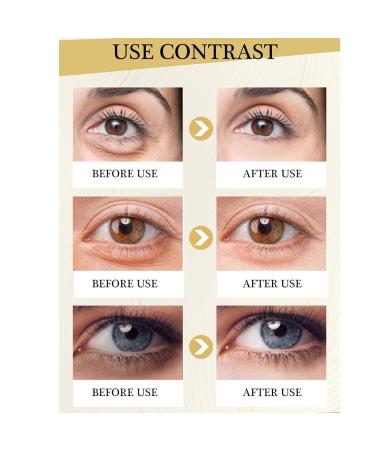 Polypeptide Eye Cream for Dark Circles & Puffiness | Anti-Aging Firming Eye Serum for Bags & Wrinkle Removal - Buy Online on GoSupps.com