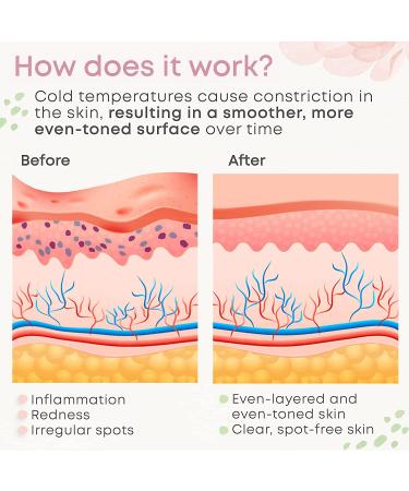 Buy Ice Roller for Face & Eye | Facial Skin Care Massager | Reduce Puffiness & Migraine Relief | Perfect Gift for Women & Men - Pink - Buy Online on GoSupps.com