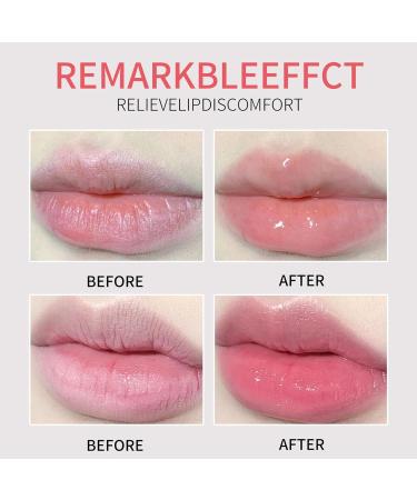 Honey Lip Balm Natural Honey Lip Balm for Chapped Cracked Dry Lips Exfoliating Plumping and Moisturizing Lip Care Products Soothes and Nourishes Your Lips - Buy Online on GoSupps.com