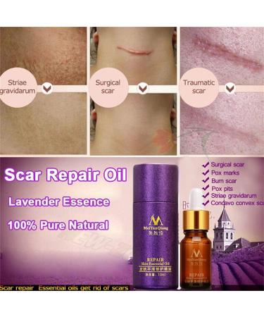 10ml Lavender Scar Oil for Men - Skin Care Solution for Scars, Personal Care - Brown - Buy Online on GoSupps.com