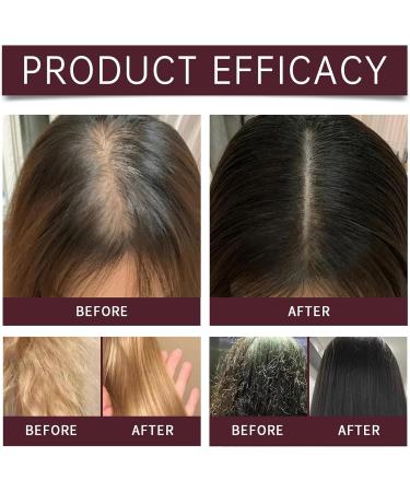 Batana Oil Shampoo Batana Oil and Rosemary Shampoo Rosemary Extract Shampoo Batana Shampoo for Hair Loss (3 Bottles) - Buy Online on GoSupps.com