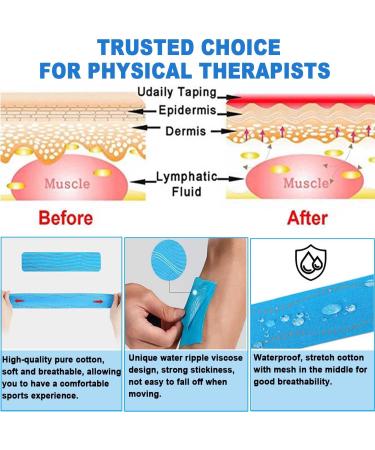 ATETEO Kinesiology Tape K-light Blue S - 5m x 2.5cm | Supportive Athletic Tape - Buy Online on GoSupps.com